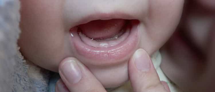 режутся зубы, режутся зубы как помочь ребенку