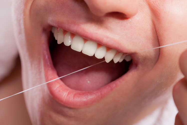 удаление зубного камня в домашних условиях профилактика