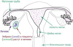 Процесс нахождения эмбриона за полостью матки