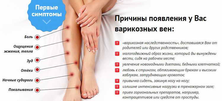 варикозное расширение вен на ногах лечение