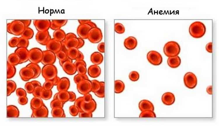 как быстро поднять гемоглобин