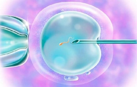 Выпуск активного сперматозоида в яйцеклетку
