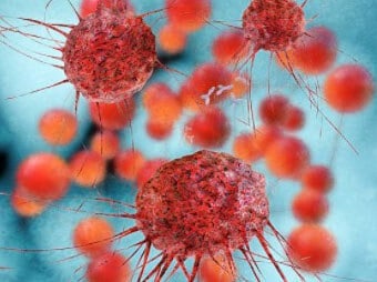 Пораженные клетки и метастазы