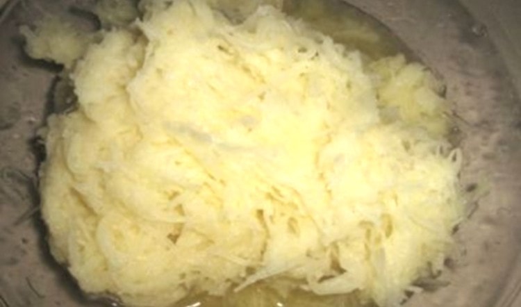 Для лечения натоптыша можно также использовать компресс из кашицы картофеля.