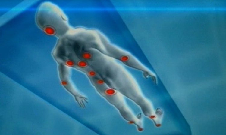 Лечение пролежней у лежачих больных обычно сосредотачивается на конкретных точках на теле.