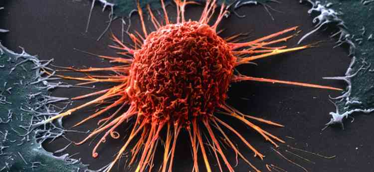 Ашваганда поможет остановить рост раковых клеток