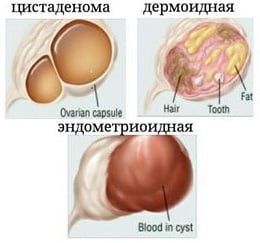 Какие бывают и чем отличаются