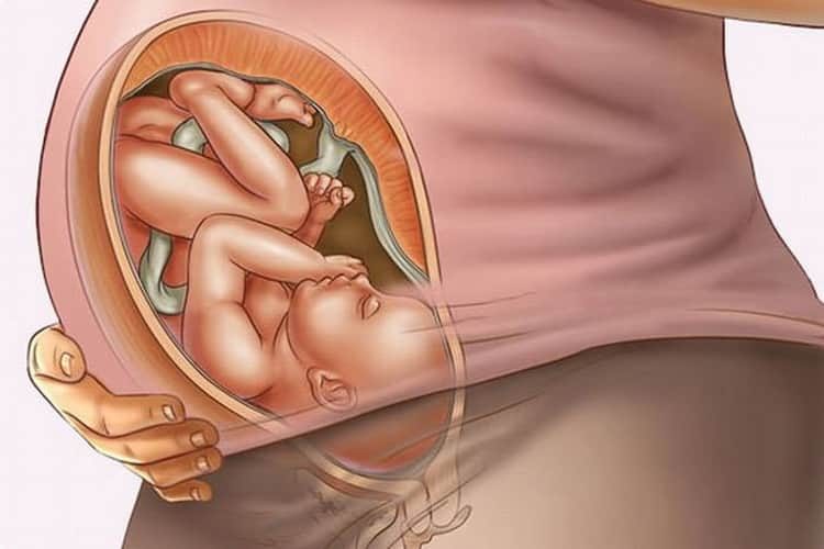 Геморрой при беременности: чем лечить в домашних условиях