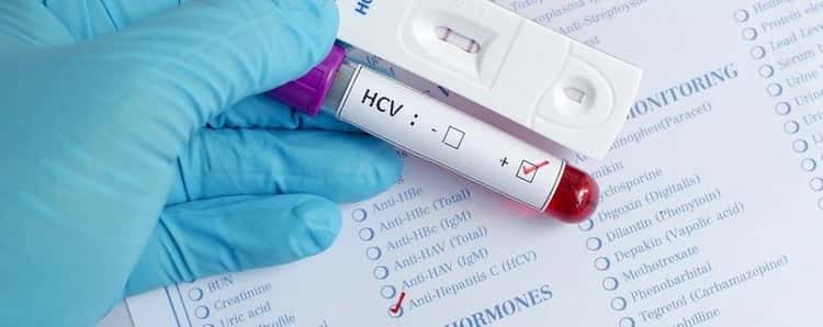 Гепатит С: симптомы и лечение народными средствами в домашних условиях