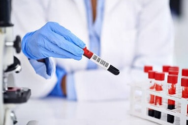 Показатели биохимического анализа крови