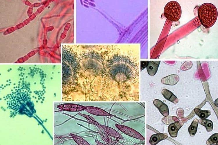 Спровоцировать воспалительный процесс в почках могут несколько видов бактерий.