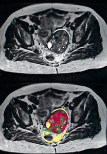 Полученные снимки в результате прохождения МРТ